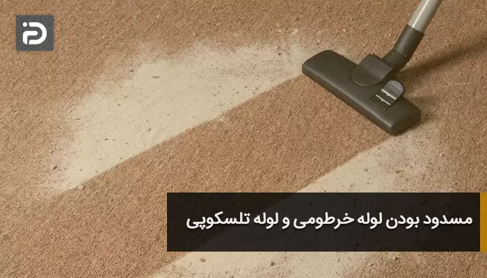 مسدود بودن لوله خرطومی و لوله تلسکوپی